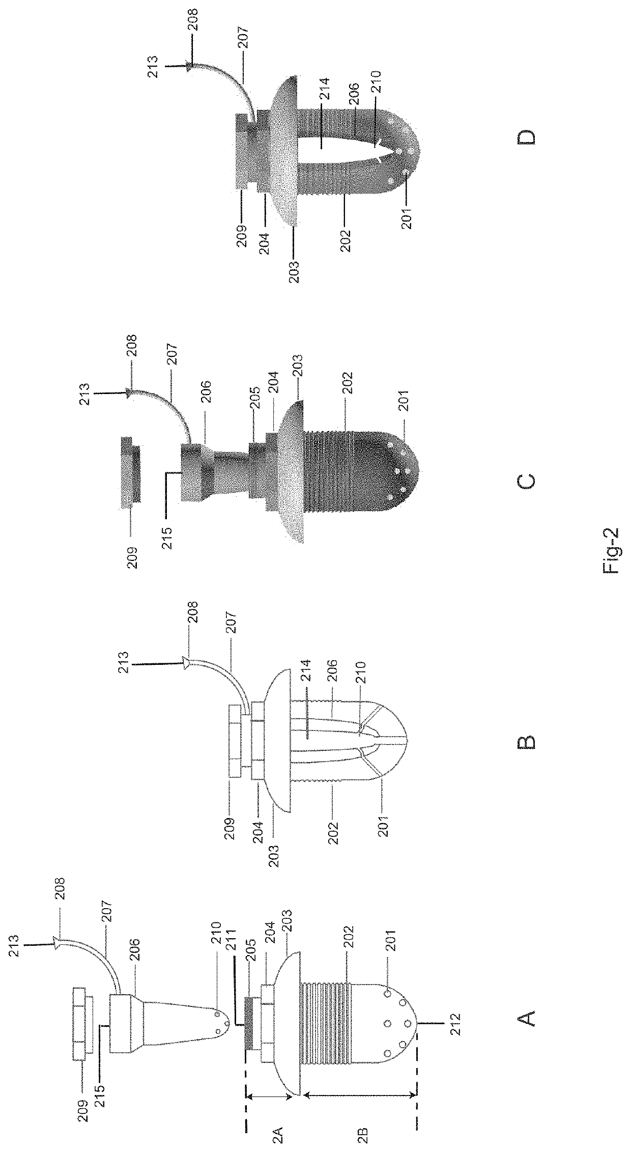 Drug delivery system and method for controlled and continuous delivery of drugs into the brain by bypassing the blood brain barrier.