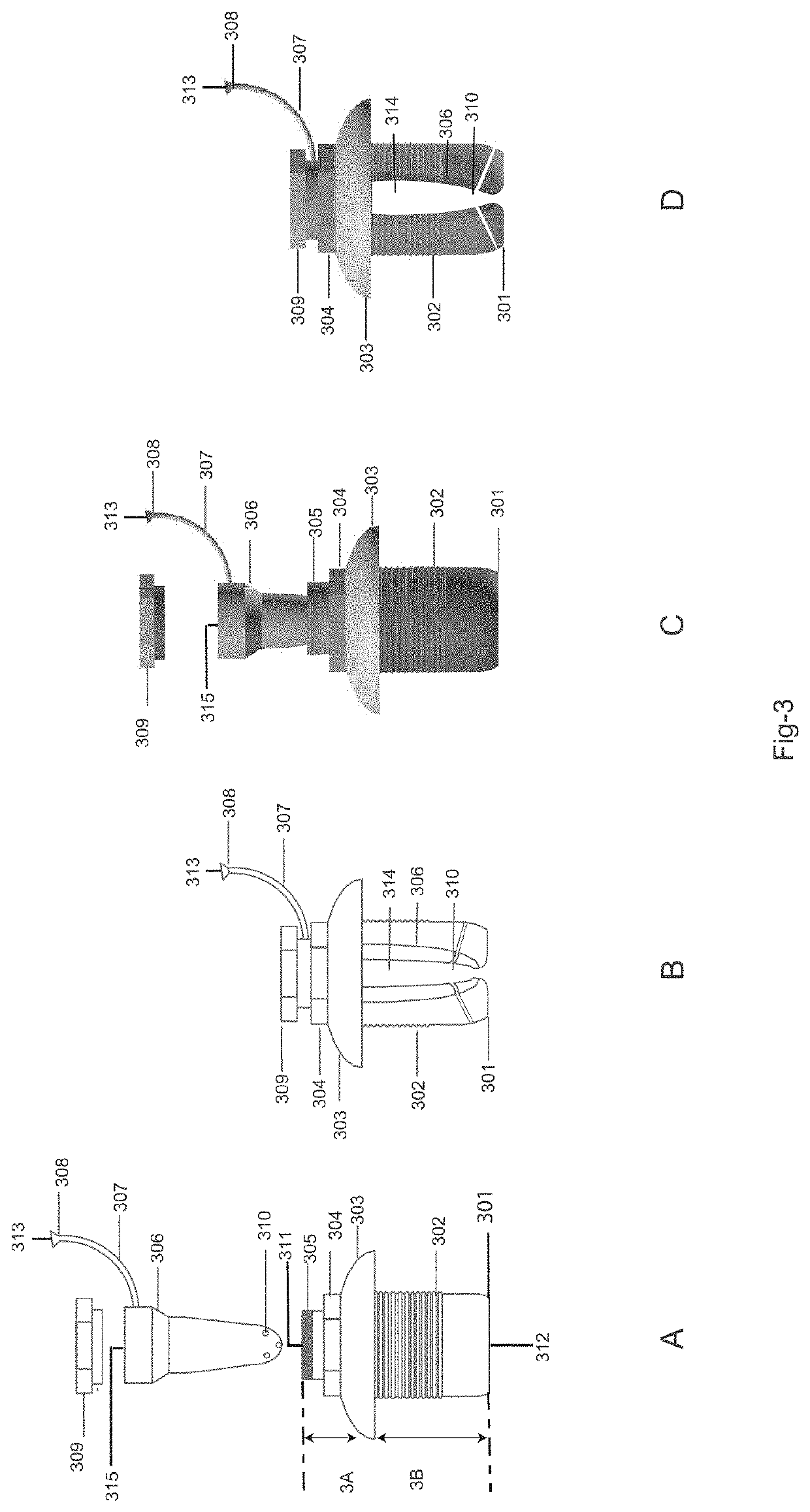 Drug delivery system and method for controlled and continuous delivery of drugs into the brain by bypassing the blood brain barrier.