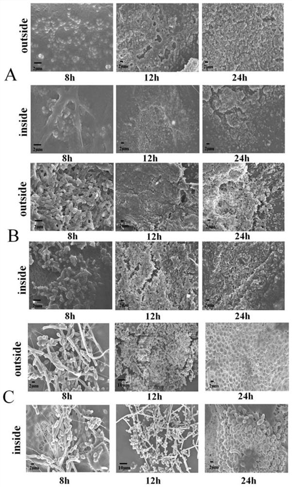 A kind of medical composite nanofiber dressing and its preparation method and application