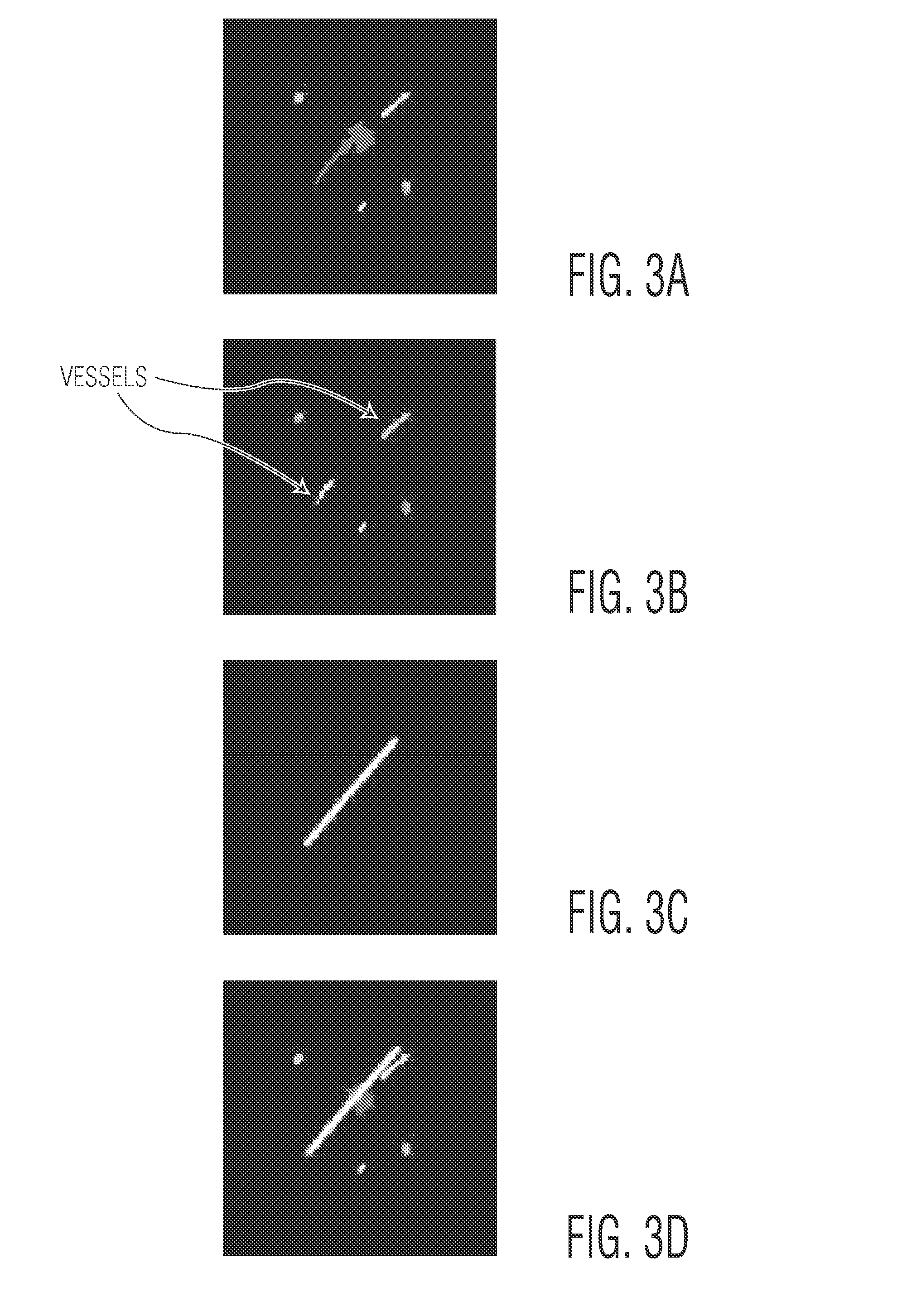 System and Method for Solid Component Evaluation in Mixed Ground Glass Nodules