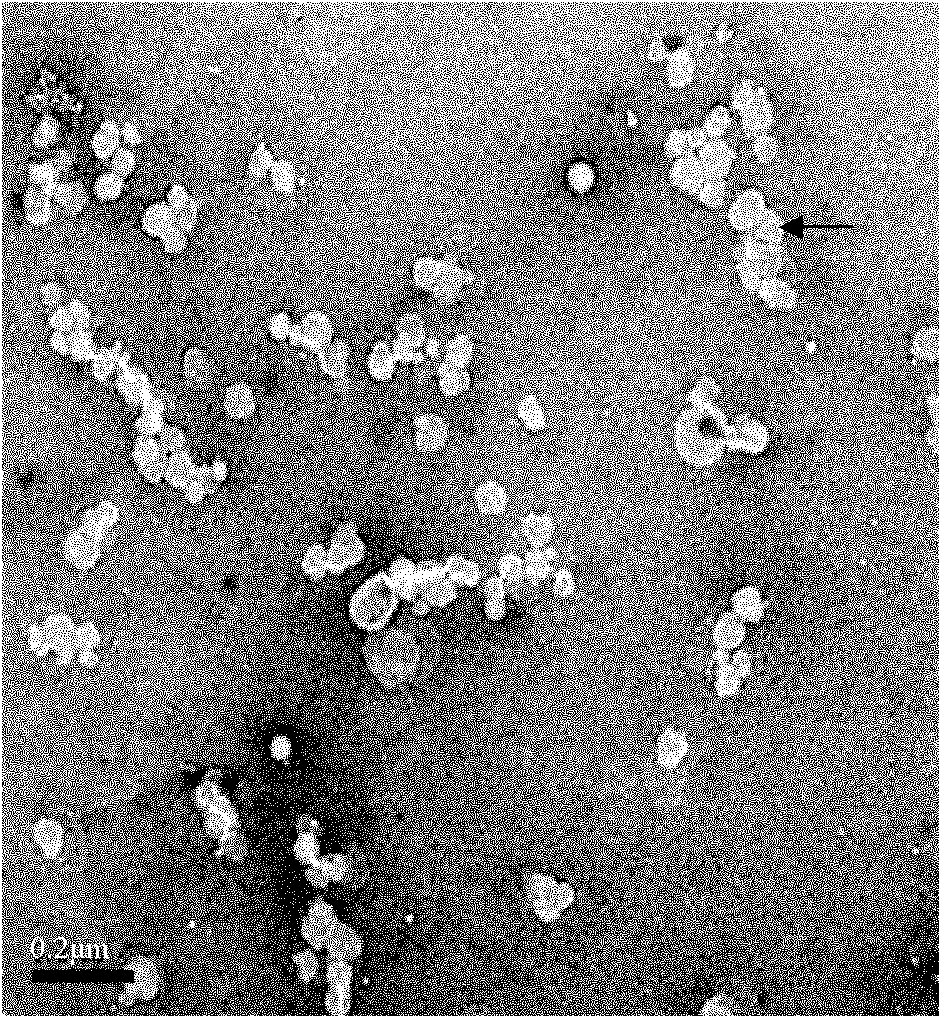 Endoglin antibody coupled liposome as well as preparation method and application thereof