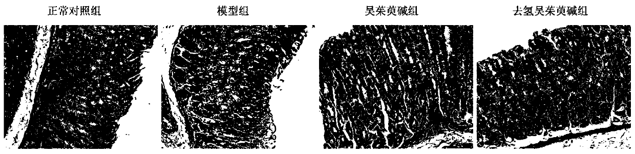 Application of dehydroevodiamine in preparation of drug used for treating acute gastritis