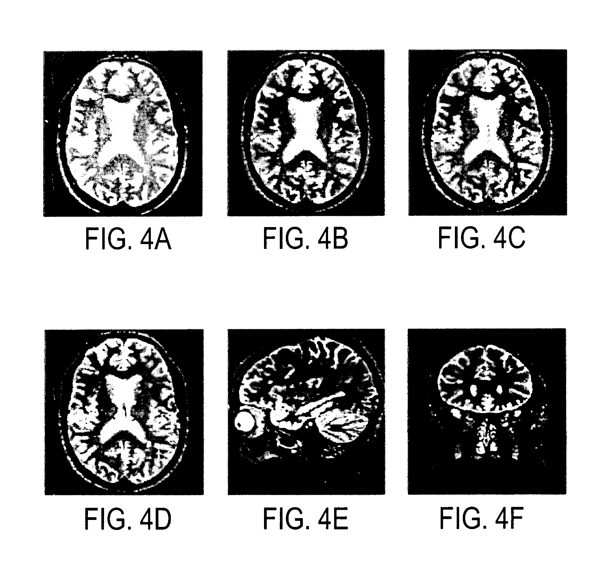 Method and apparatus for spin-echo-train MR imaging using prescribed signal evolutions