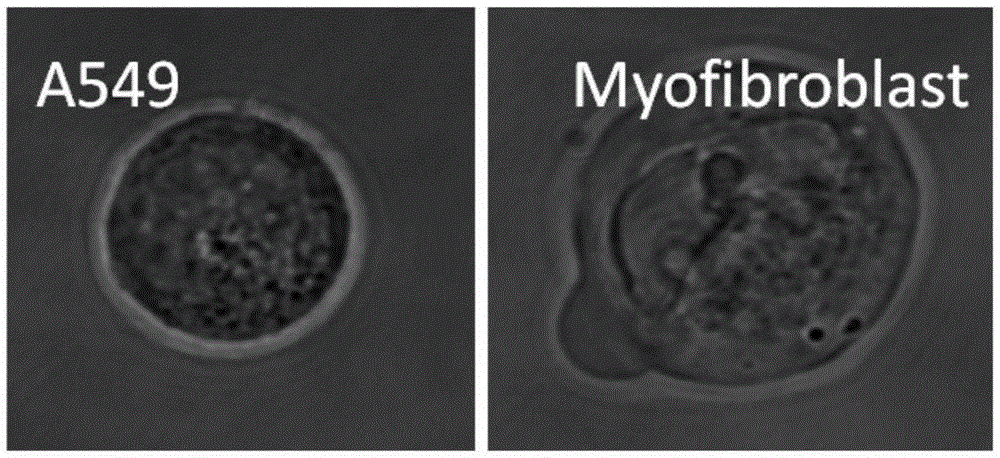 Application of rhamnolipid in preparation of anti-fibrosis medicinal preparation