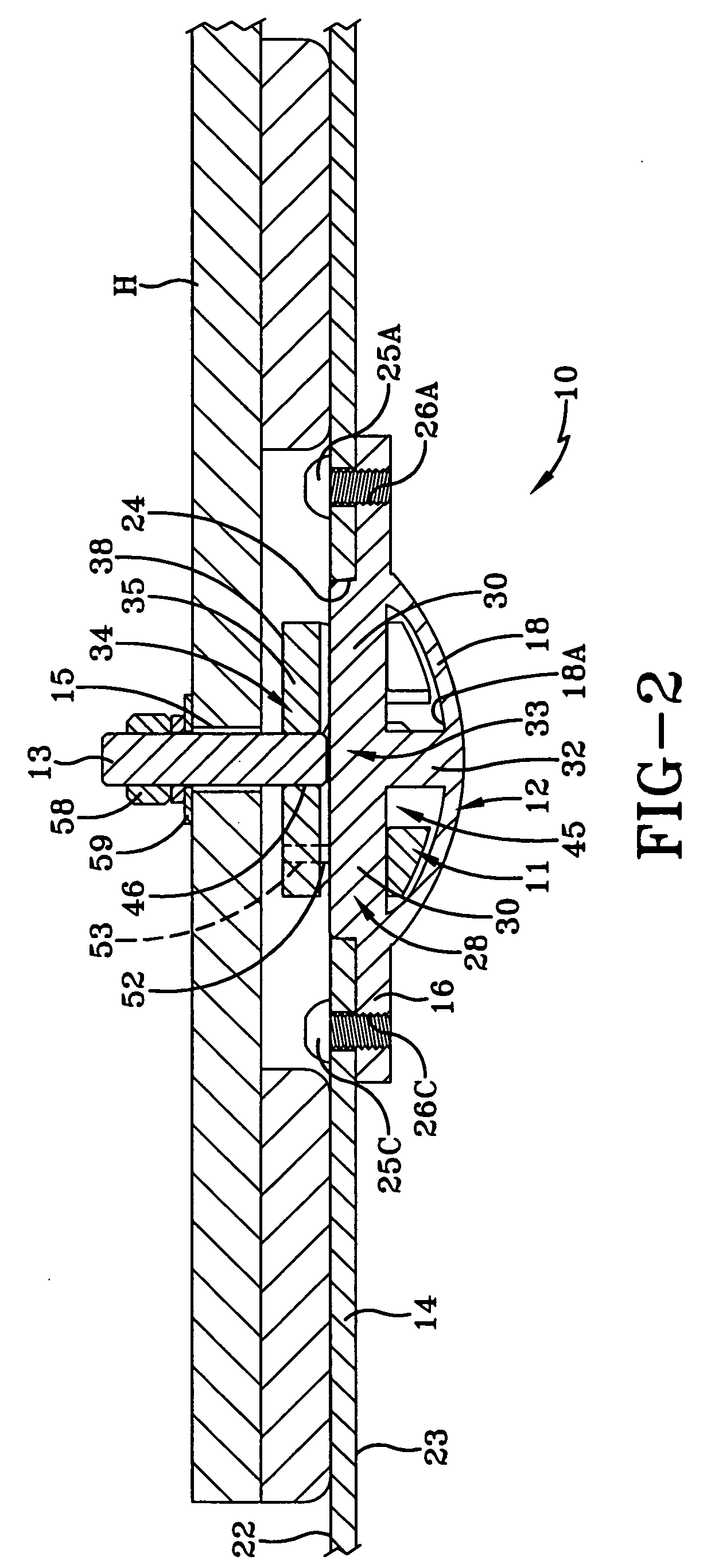 Anchoring system