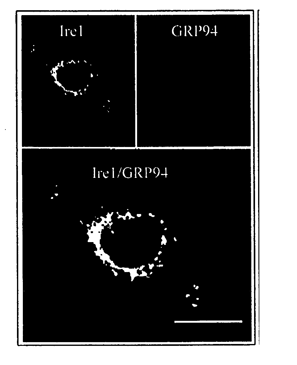 Ire1p, novel mammalian protein, and gene encoding same