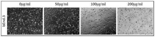 Brain blood vessel endothelial cell line for quickly detecting activity of classical Wnt signal channel