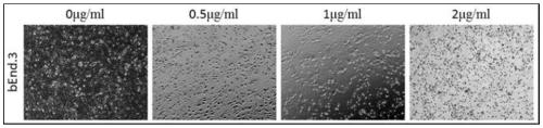 Brain blood vessel endothelial cell line for quickly detecting activity of classical Wnt signal channel