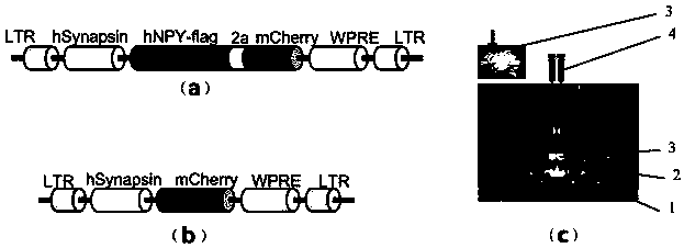 Construction method of gene overexpression chimeric animal model based on hNPY and application of construction method