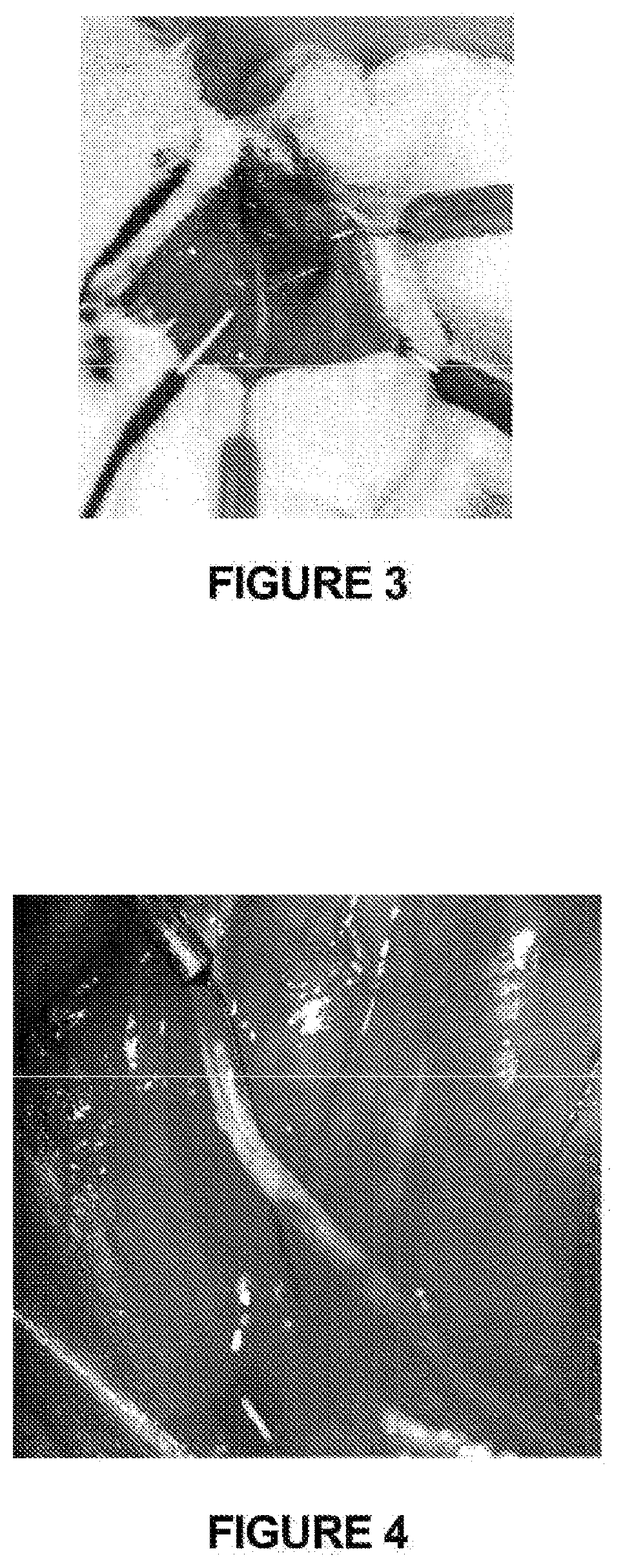 Compositions and methods for treatment of neurological disorders