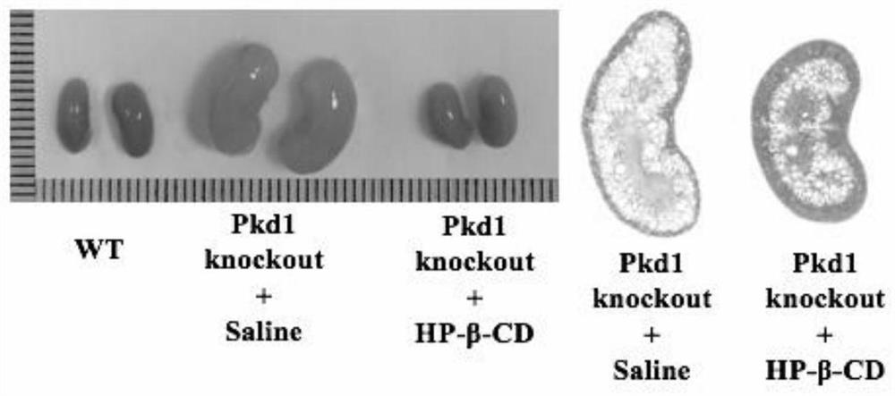 Application of cyclodextrin in preparation of medicine for treating and/or preventing polycystic kidney disease