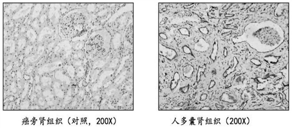 Application of cyclodextrin in preparation of medicine for treating and/or preventing polycystic kidney disease