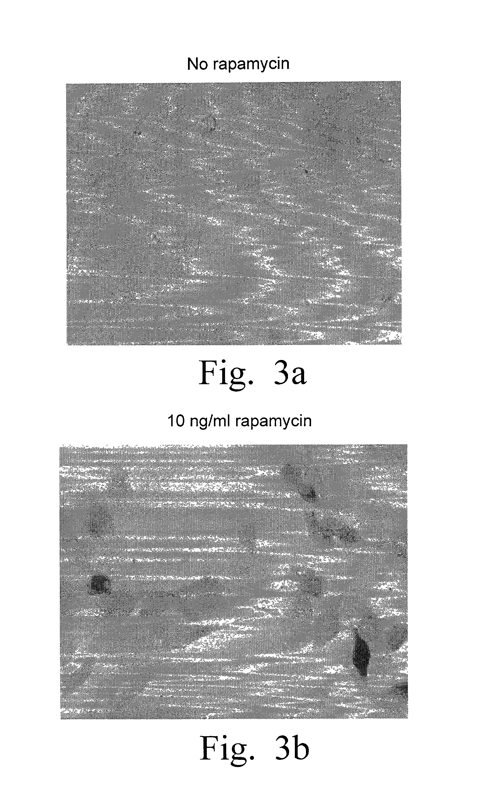 Detection of molecular interactions by reporter subunit complementation