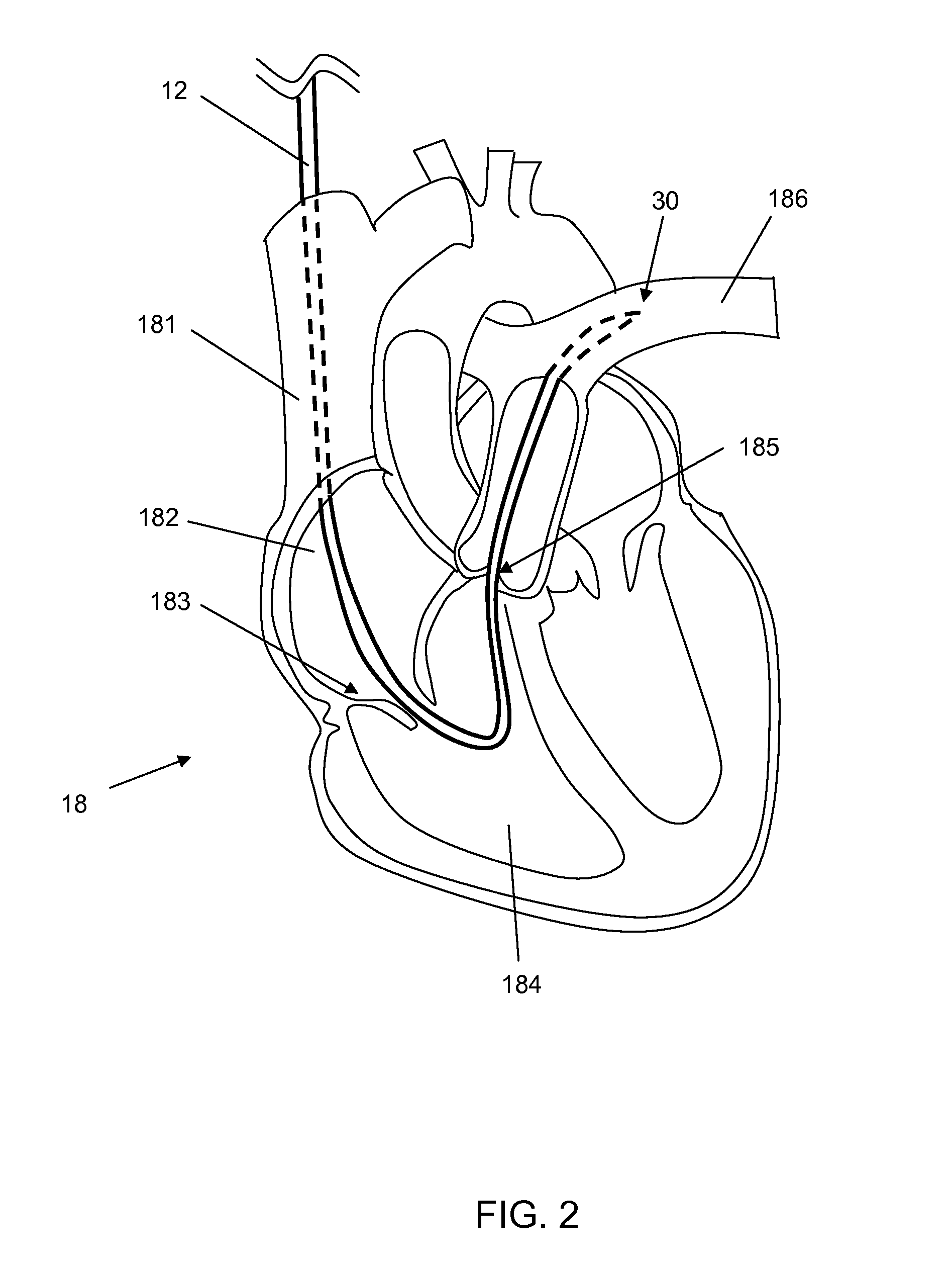 Pressure monitoring to control delivery of therapeutic agent