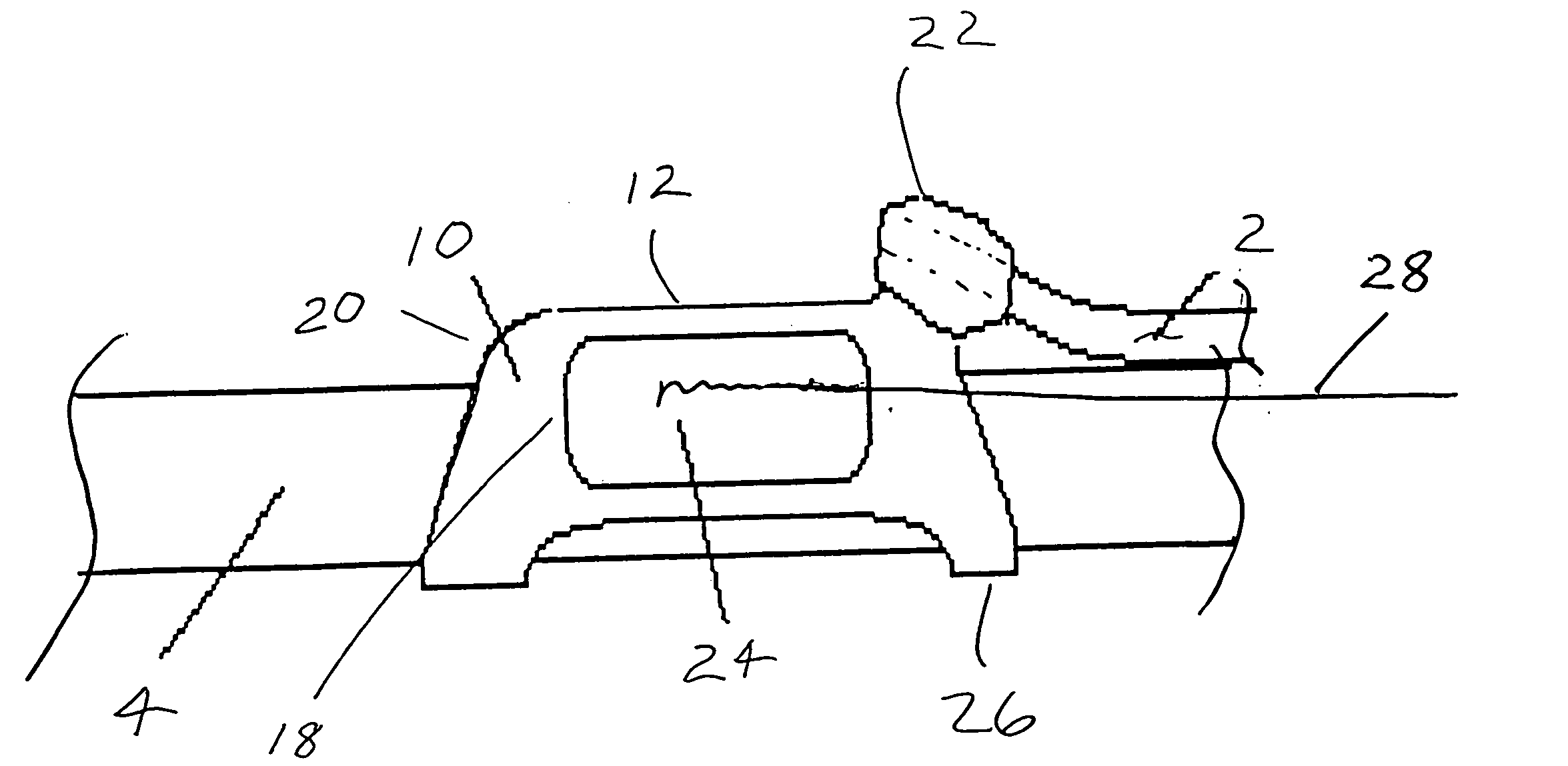 Endotracheal positioning device