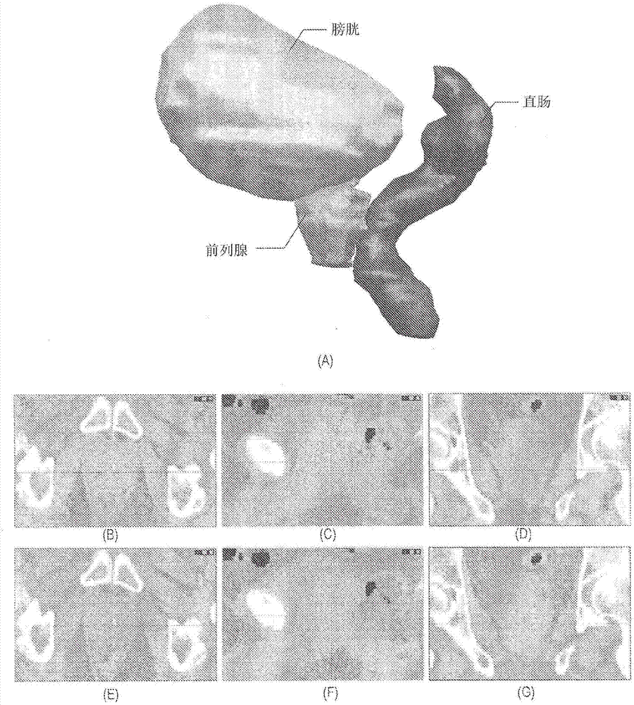 Systems and methods for segmenting medical images based on anatomical landmark-based features