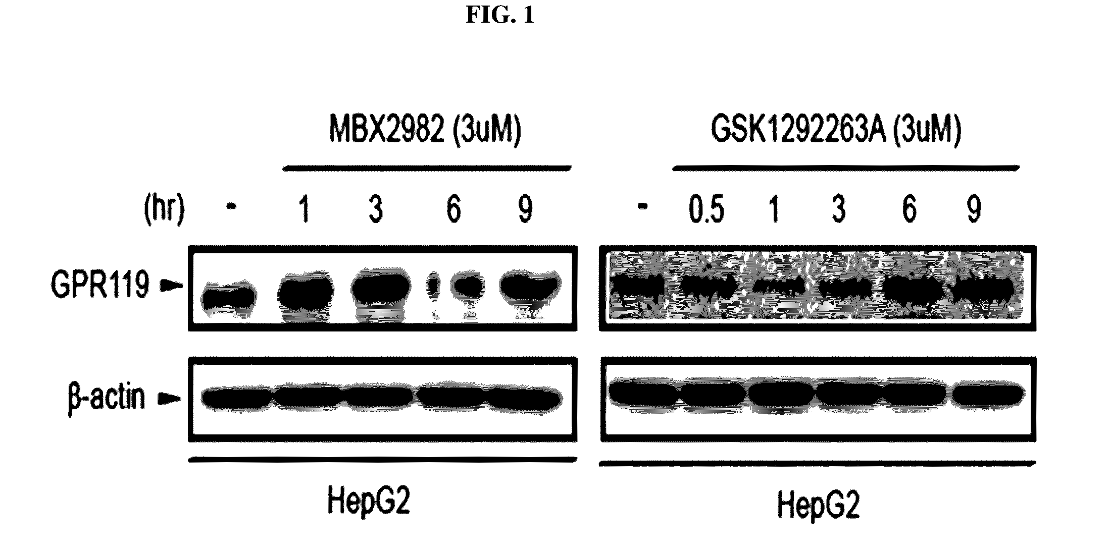 Pharmaceutical composition containing gpr119 ligand as active ingredient for preventing or treating non-alcoholic fatty liver disease