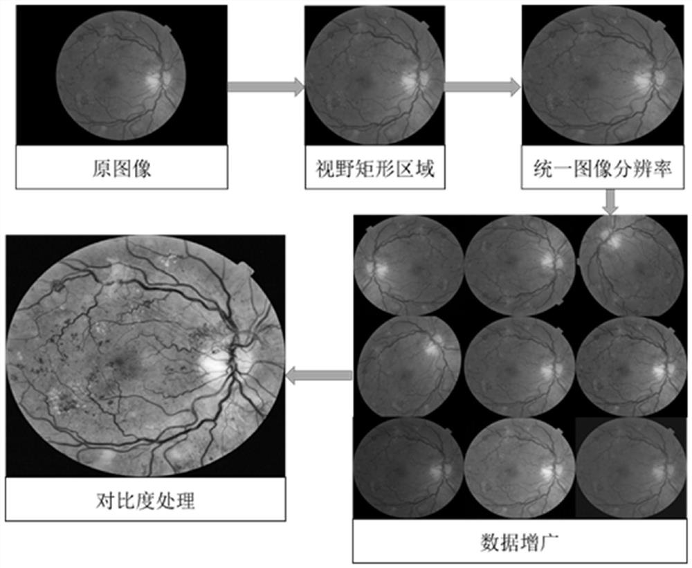 Retinal neovascularization detection method and imaging method for color fundus image