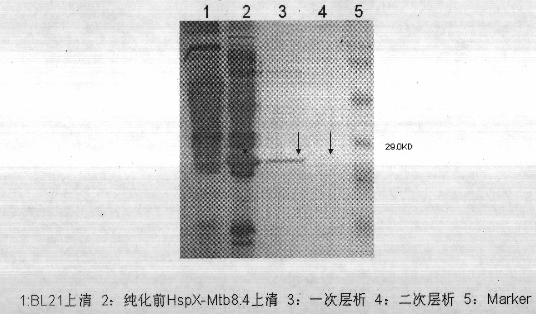 Tubercle bacillus fusion protein HspX-Mtb8.4 and preparation method and application thereof