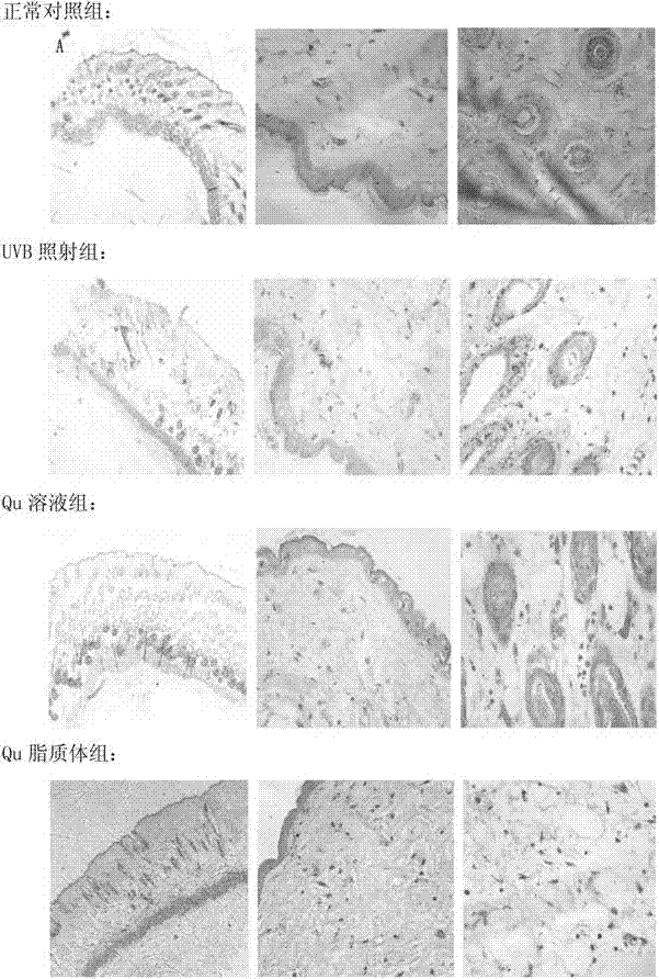 Quercetin skin lipidosome, lyophilized powder thereof and preparation method and application thereof
