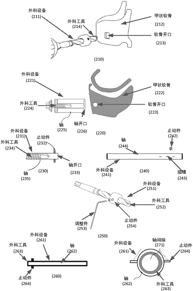 Methods and apparatus for treating glottis insufficiency