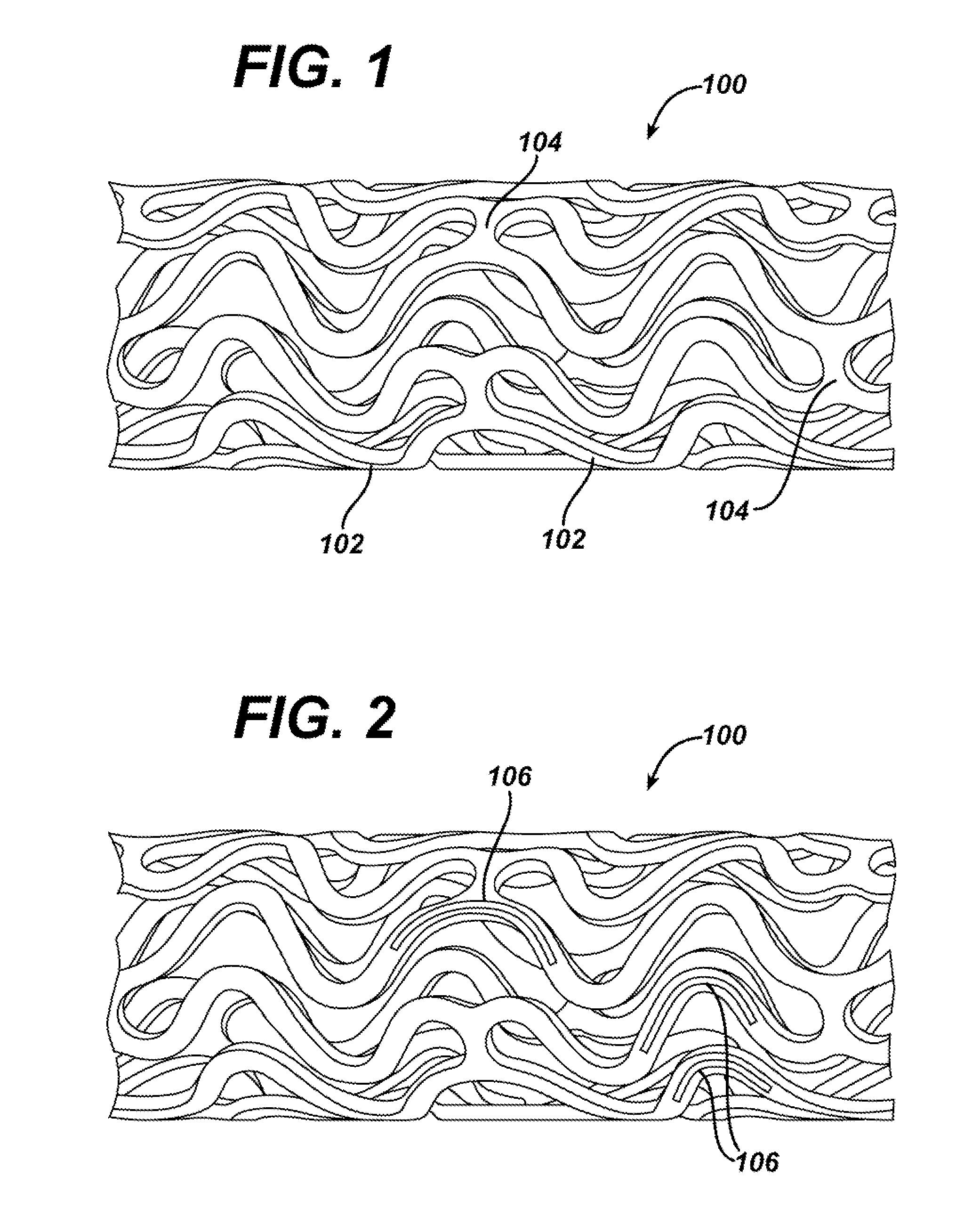 Device for local and/or regional delivery employing liquid formulations of therapeutic agents