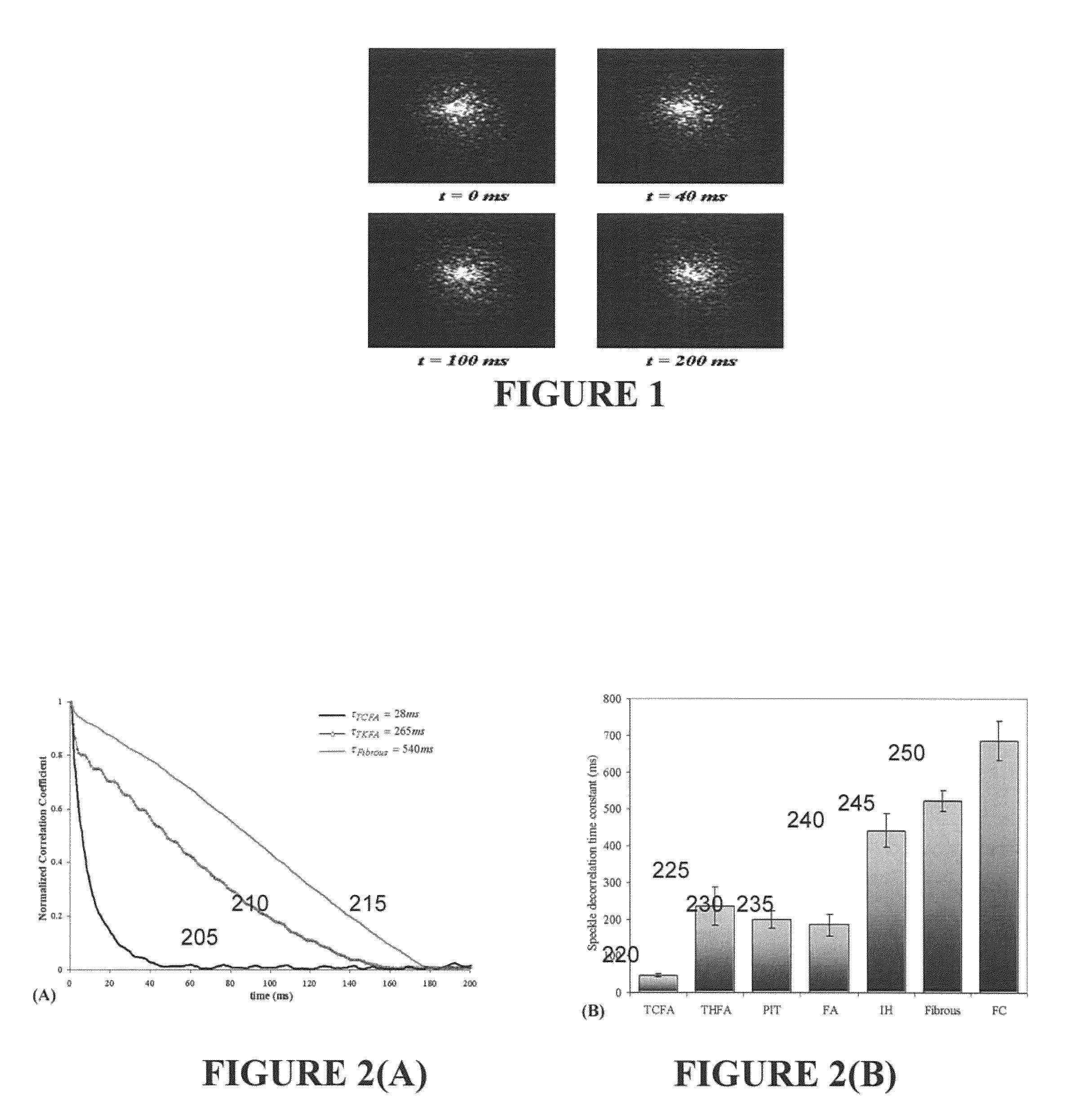 Non-contact optical system, computer-accessible medium and method for measurement at least one mechanical property of tissue using coherent speckle technique(s)