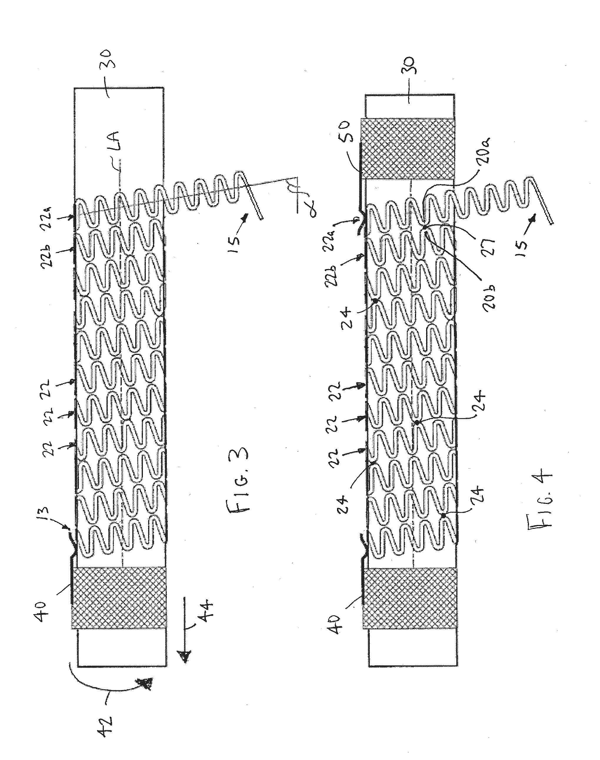 Method for forming a stent