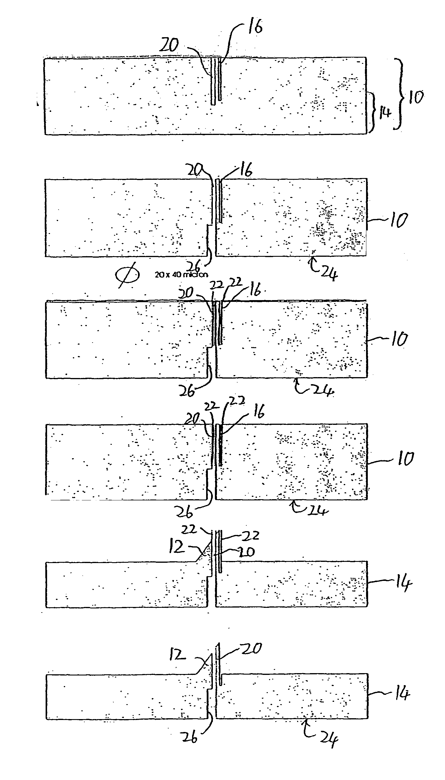 Microneedle structure and production method therefor