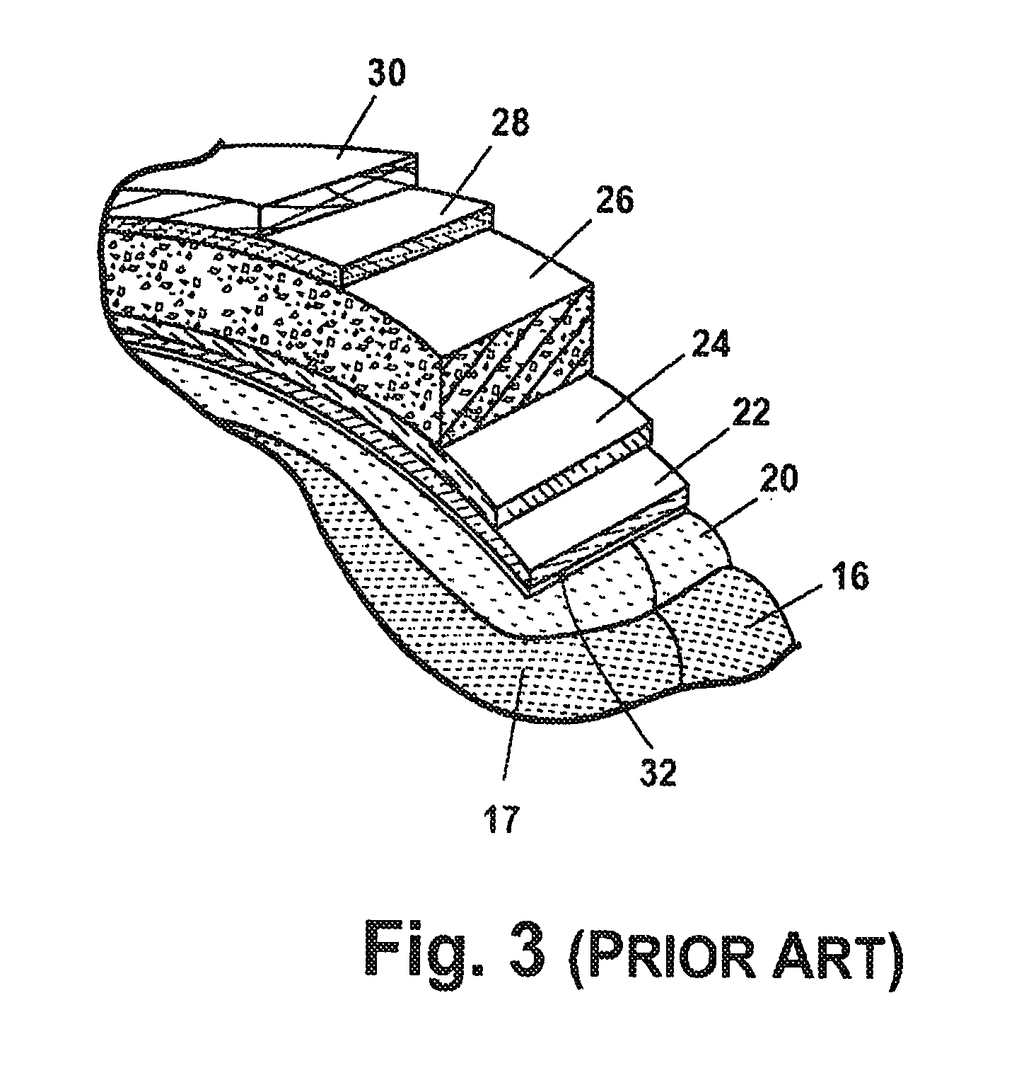 Composition and methods of treatment of bacterial meningitis