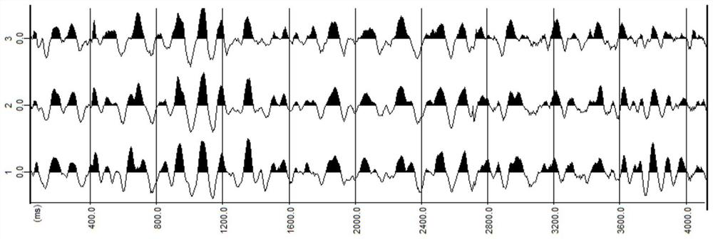 Micro-motion acquisition method