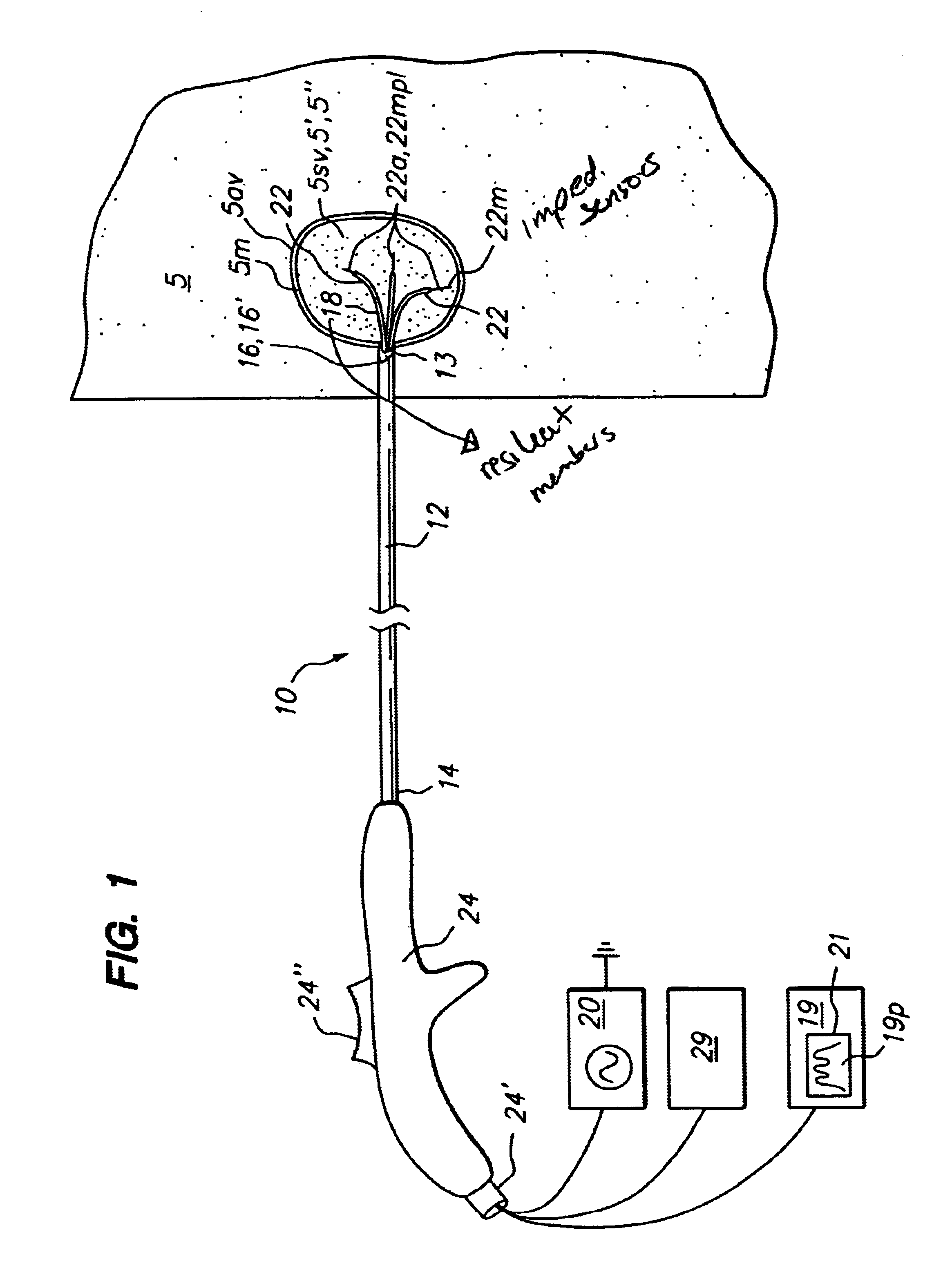Method for detecting and treating tumors using localized impedance measurement