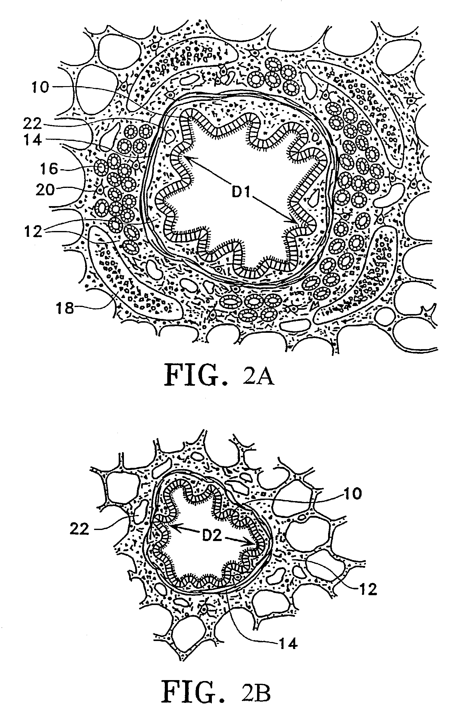 Control system and process for application of energy to airway walls and other mediums