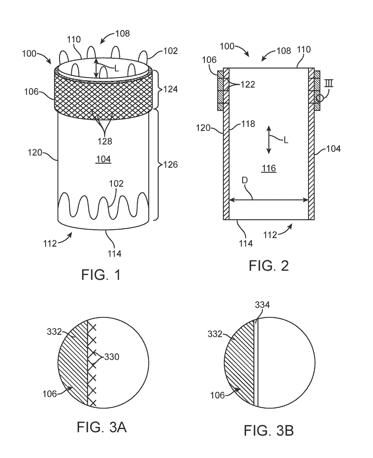 Stent graft with external scaffolding and method