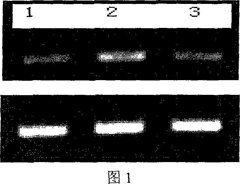 Amphioxus uncoupling protein gene and application thereof