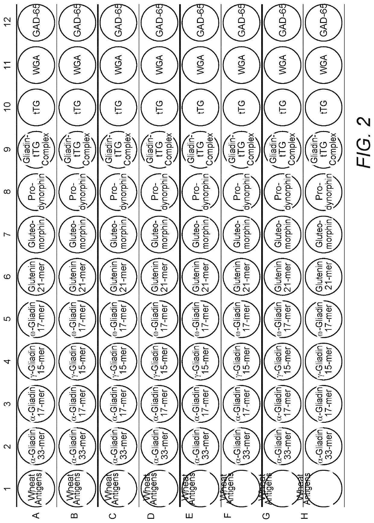 Methods and apparatus for detection of gluten sensitivity, and its differentiation from celiac disease