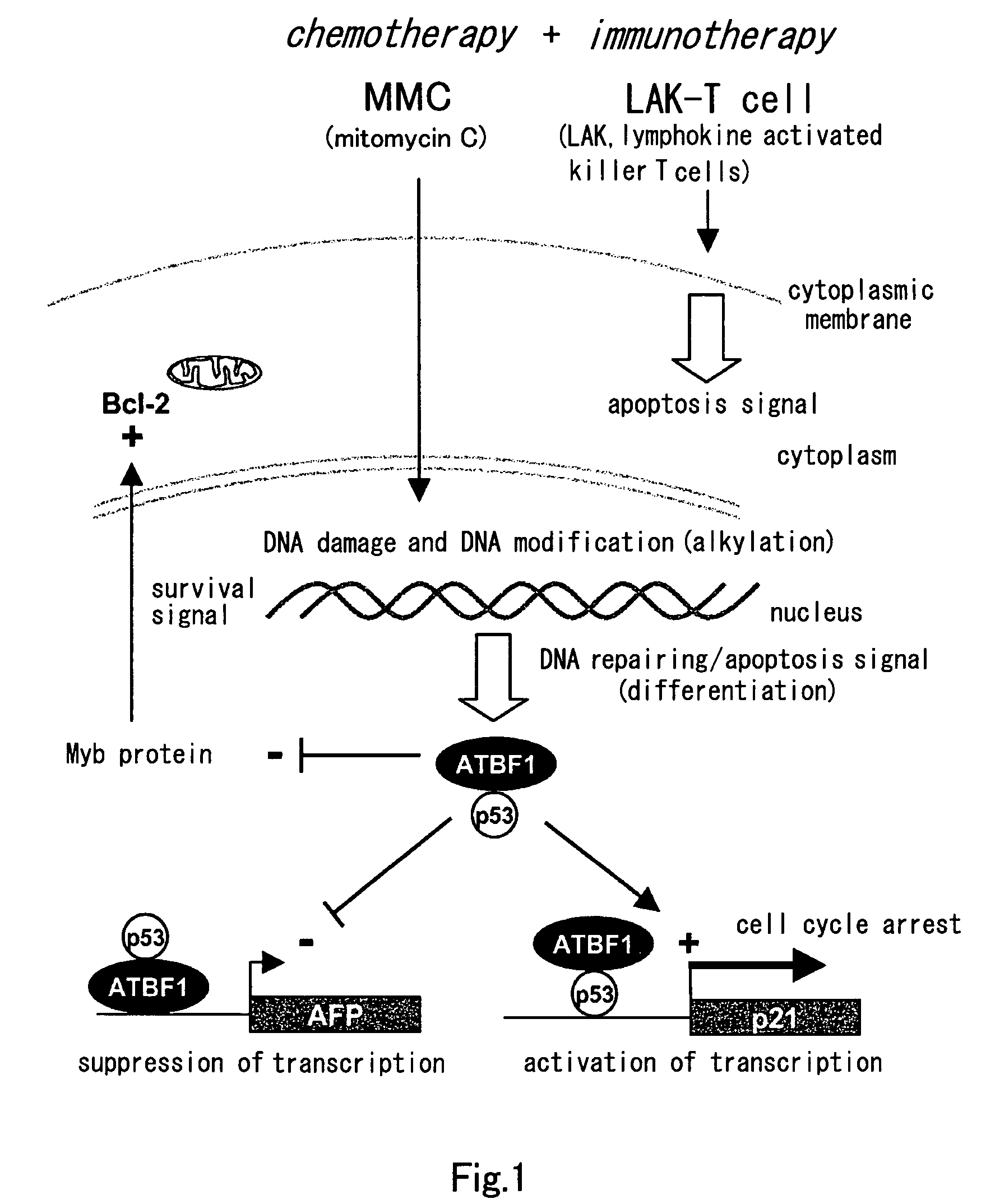 Method of judging grade of malignancy of carcinoma cell using ATBF-1