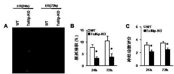 Application of Toll interacting protein (Tollip) in stroke disease