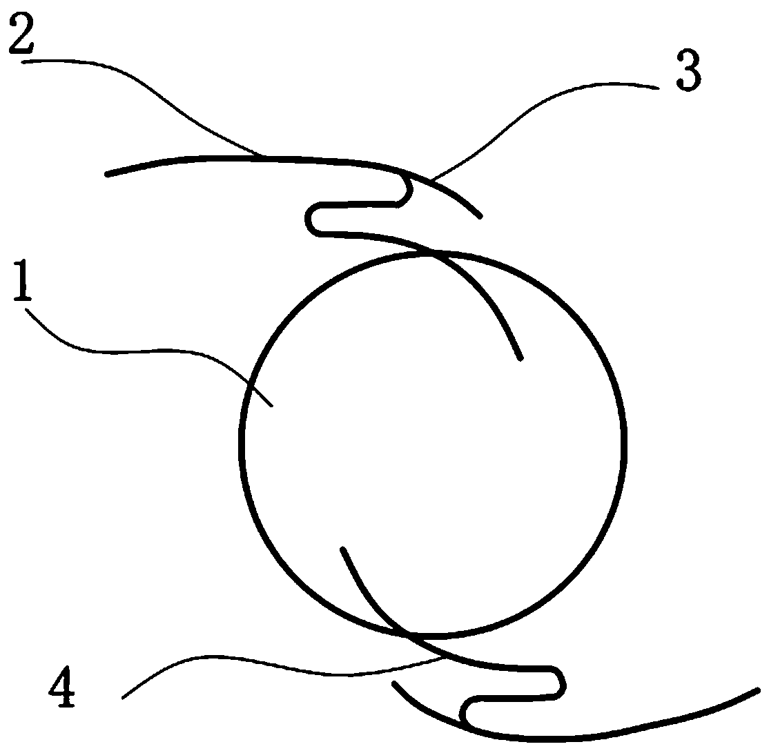 Scleral fixed intraocular lens