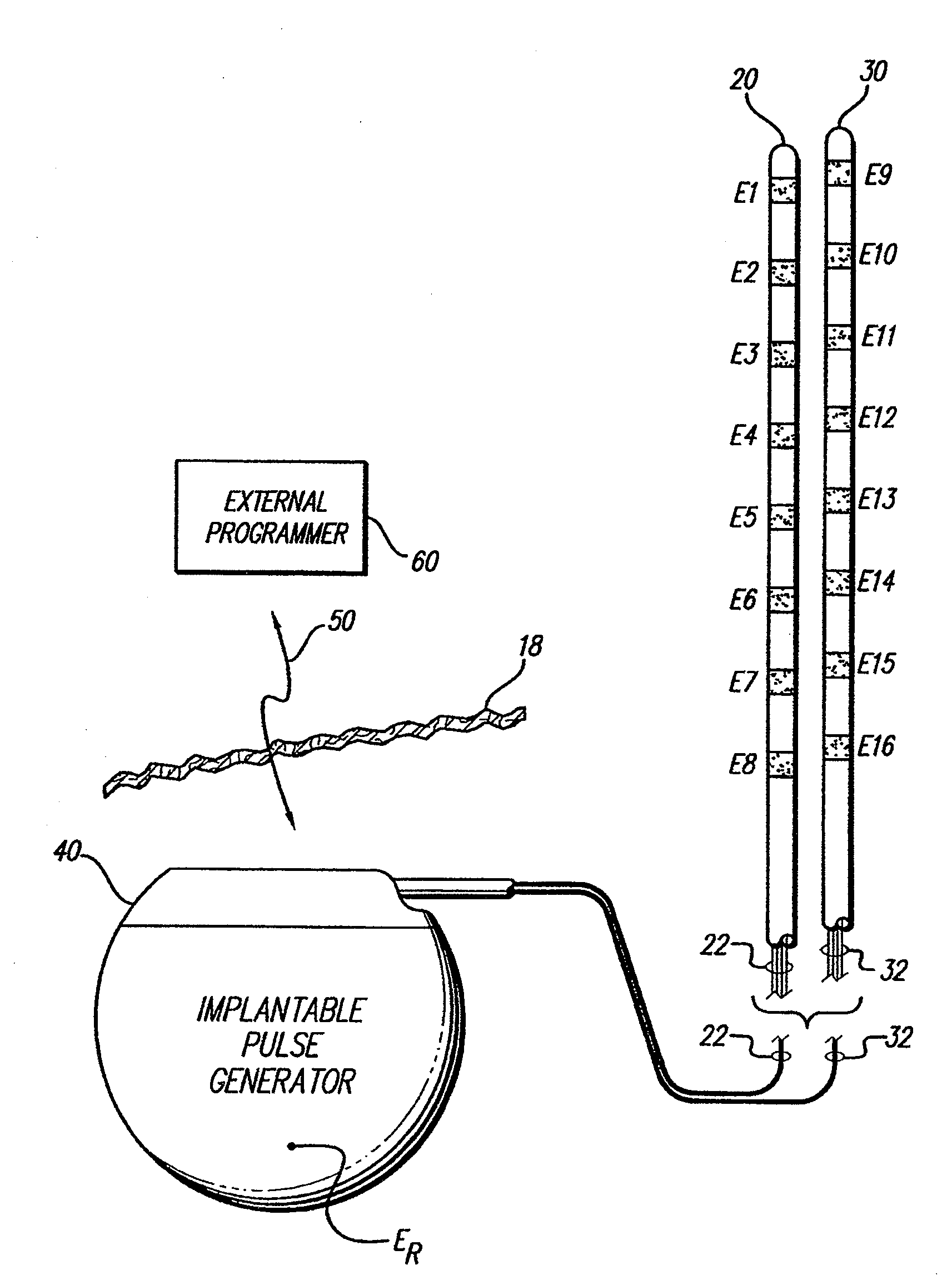 Apparatus and method for determining the relative position and orientation of neurostimulation leads