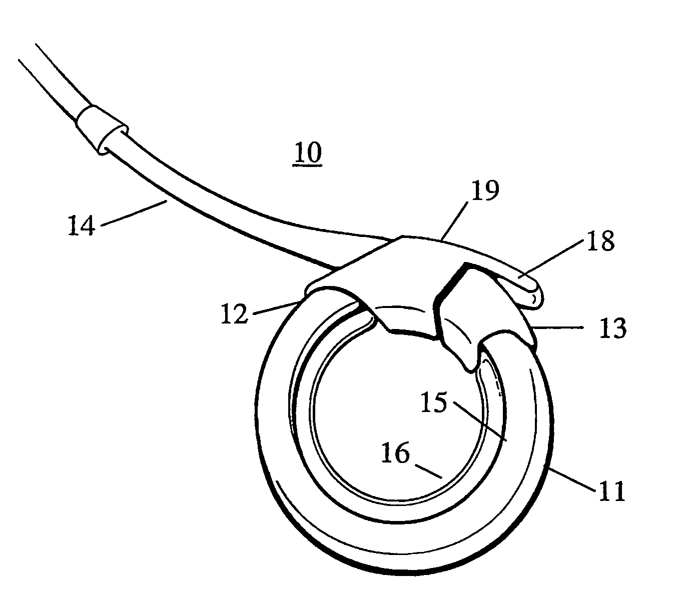 Remotely adjustable gastric banding device and method