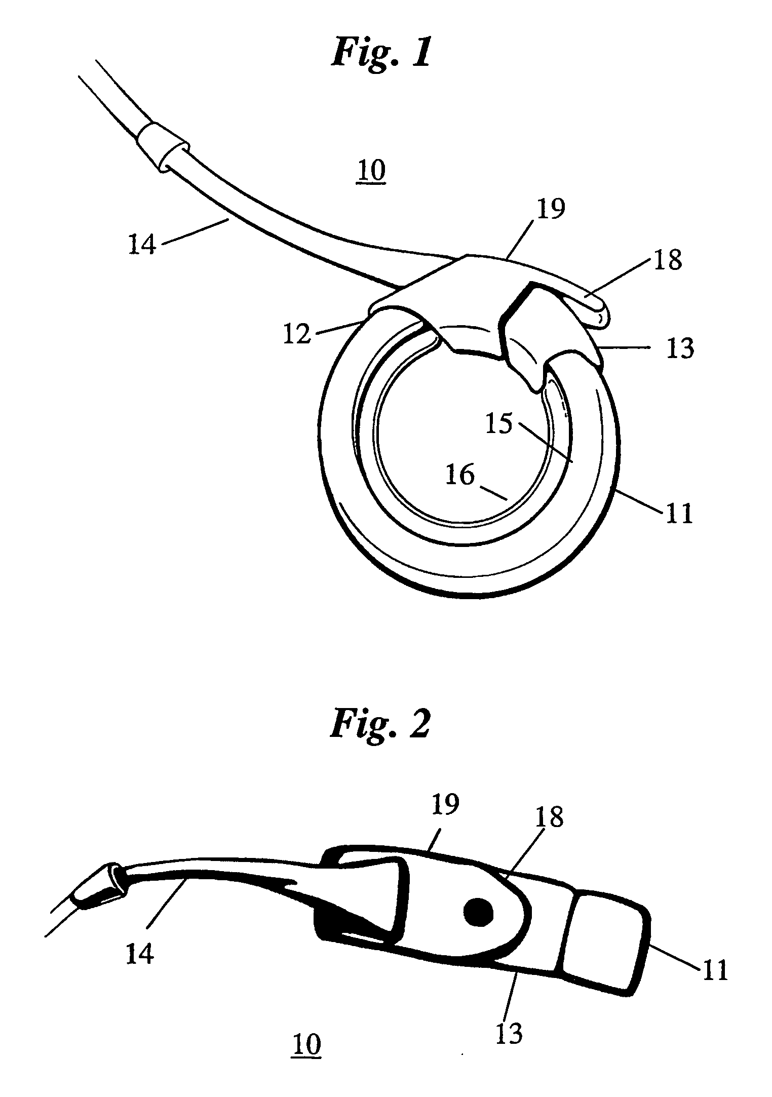 Remotely adjustable gastric banding device and method
