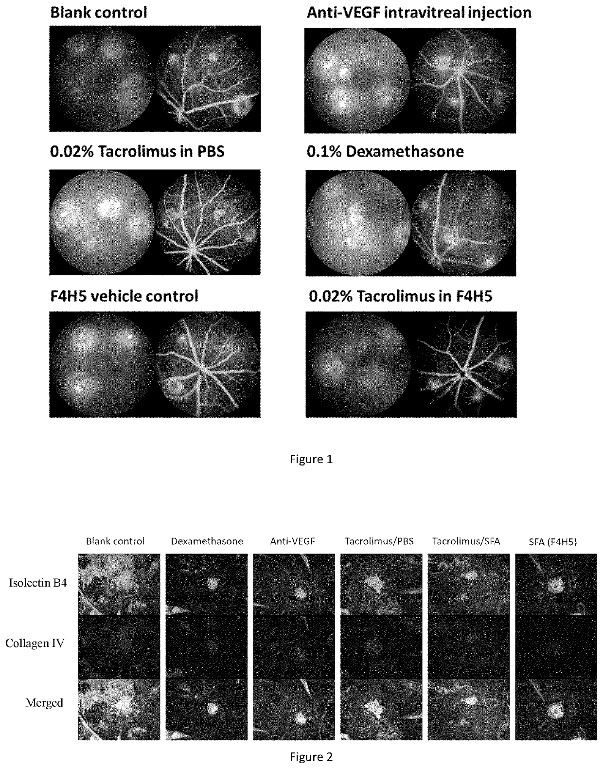 Pharmaceutical composition for the treatment of ocular neovascularisation