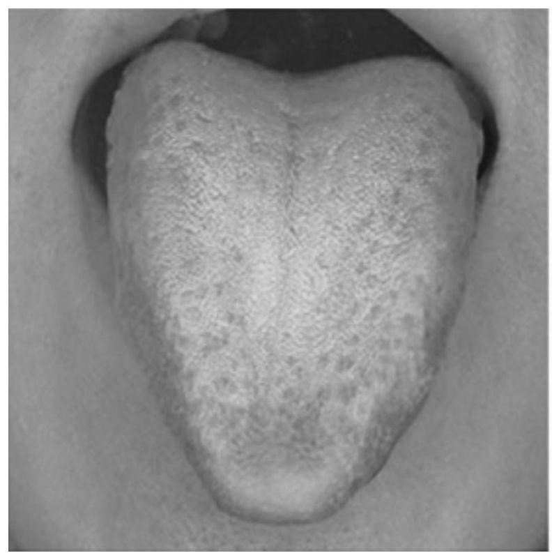 Tongue body color identification method and device based on image processing