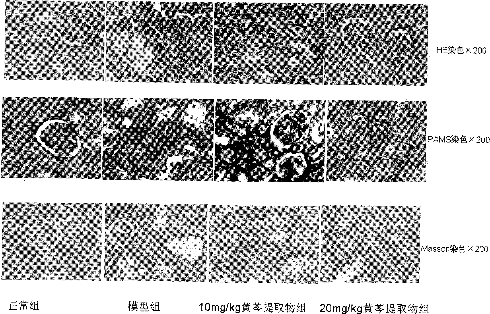 Scullcap total-flavonoid aglycone extract, preparation method and use thereof