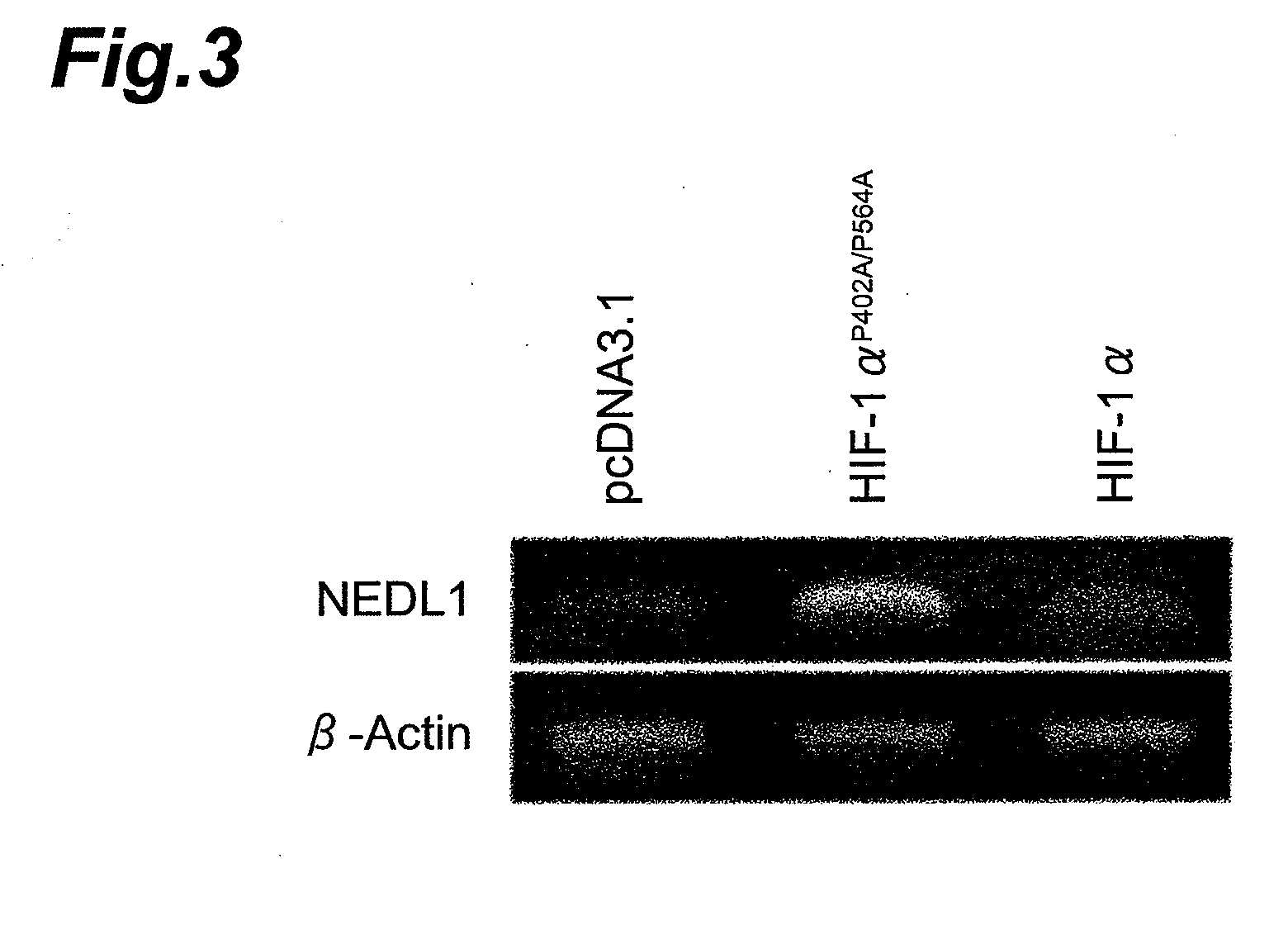 Screening method for compound inhibiting development or progression of familial amyotrophic lateral sclerosis and diagnostic method for familial amyotrophic lateral sclerosis