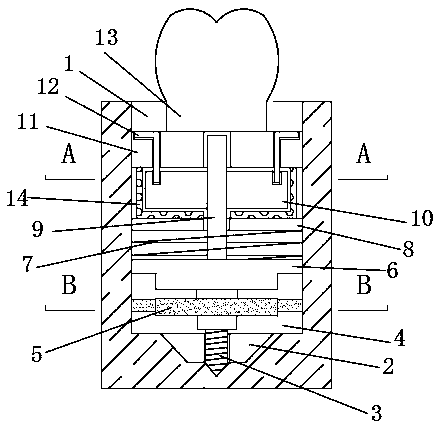 Oral implant device