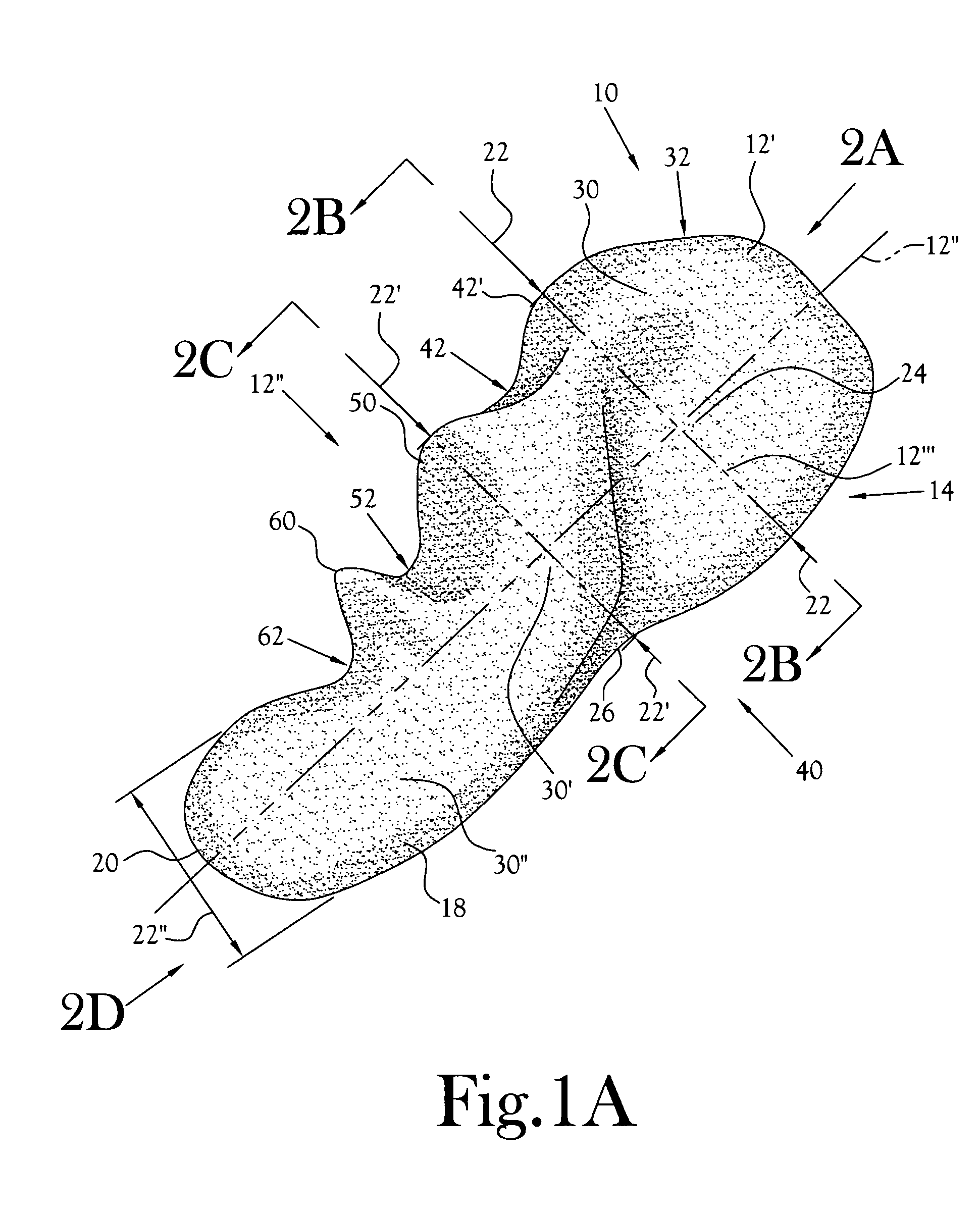 Hand held orthosis having a flexible enclosure and method of utilization