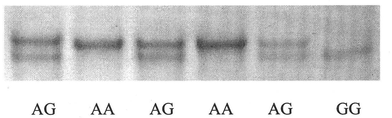 Single nucleotide polymorphism of ox TAS1R2 gene and detecting method thereof