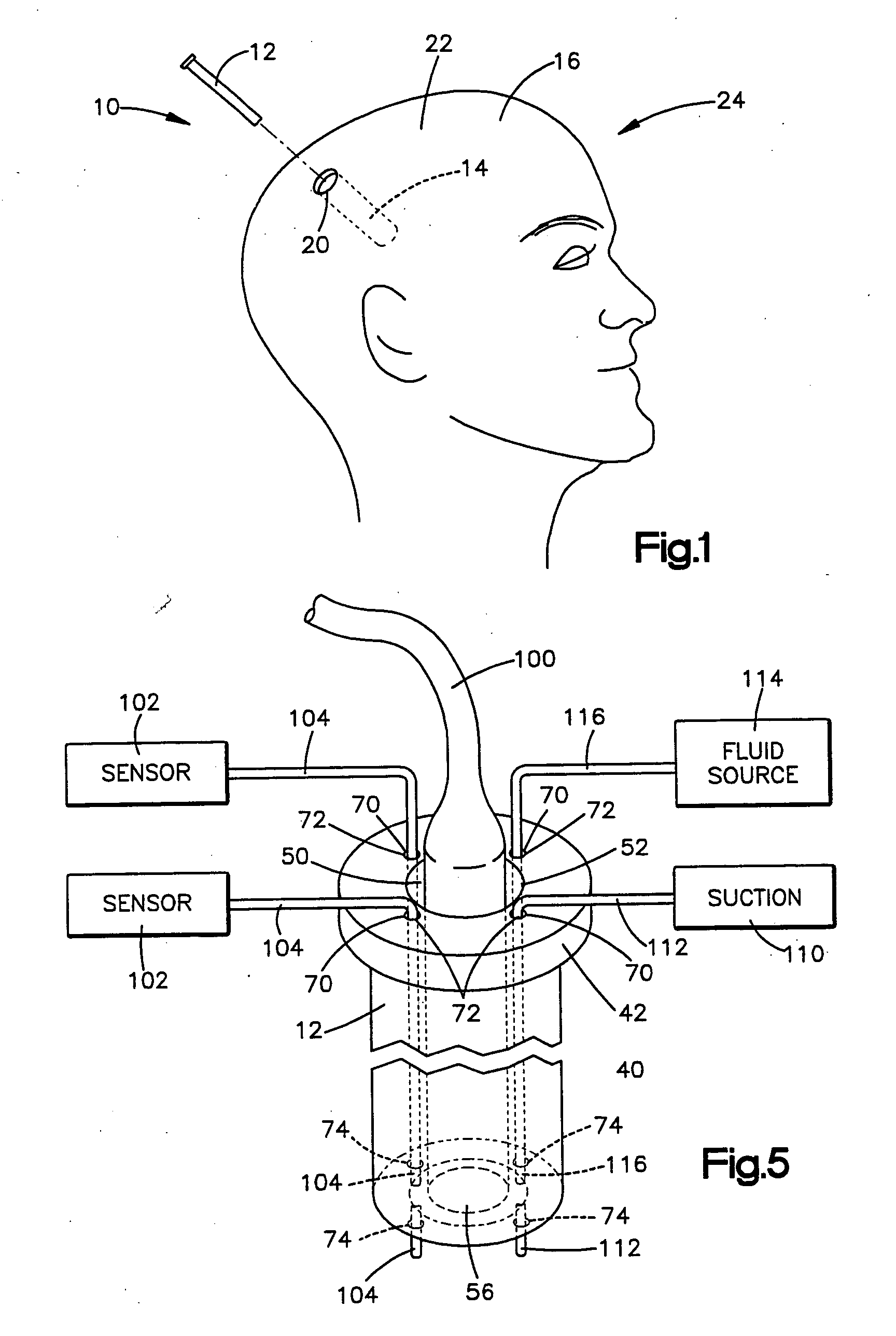 Apparatus for facilitating delivery of at least one device to a target site in a body